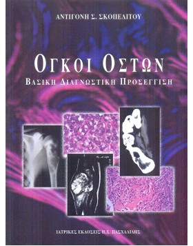 Όγκοι Οστών