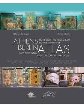 Αθήνα-Βερολίνο-Εικόνες από το Ανθρώπινο Σώμα-Εικόνες Νόσου-Ένας Διεθνής Άτλας Παθολογοανατομικών Παρασκευασμάτων/ Athens-Berlin Menschliche Korperbilder-Krankheitsbilder Ein Internationaler Atlas Pathologischer Praparate/ Athens-Berlin Pictures of the Hum